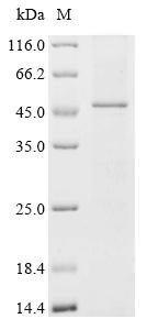 Recombinant Human Protein-serine O-palmitoleoyltransferase porcupine (PORCN) Protein, Homo sapiens (Human), in vitro E.coli expression system, N-terminal 10xHis-tagged, 53.8kDa, purity >85% as determined by SDS-PAGE.