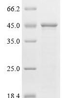 (Tris-Glycine gel) Discontinuous SDS-PAGE (reduced) with 5% enrichment gel and 15% separation gel.