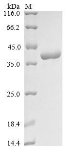 Recombinant Clostridium perfringens N-acetylneuraminate lyase (nanA)