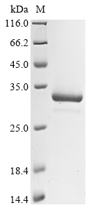 Recombinant Clostridium perfringens N-acetylneuraminate lyase (nanA), Clostridium perfringens (strain SM101 / Type A), Yeast, C-terminal 6xHis-tagged, 34.0kDa, purity >90% as determined by SDS-PAGE.