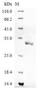 Recombinant Clostridium perfringens Putative N-acetylmannosamine-6-phosphate 2-epimerase (nanE)