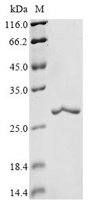 Recombinant Dictyostelium discoideum Nucleoside diphosphate kinase, cytosolic (ndkC-1)