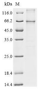 Recombinant Macaca fascicularis Parathyroid hormone/parathyroid hormone-related peptide receptor (PTH1R) Protein, Macaca fascicularis (Crab-eating macaque) (Cynomolgus monkey), in vitro E.coli expression system, N-terminal 10xHis-tagged, 61.7kDa, purity >85% as determined by SDS-PAGE.