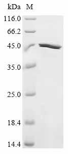Recombinant Rat Neurofilament heavy polypeptide (Nefh), partial, Rattus norvegicus (Rat), E.coli, N-terminal 10xHis-tagged and C-terminal Myc-tagged, 44.2kDa, purity >85% as determined by SDS-PAGE.