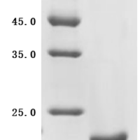 (Tris-Glycine gel) Discontinuous SDS-PAGE (reduced) with 5% enrichment gel and 15% separation gel.