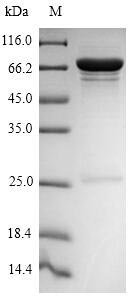 Recombinant Influenza A virus Nucleoprotein (NP), Influenza A virus (strain A/Beijing/353/1989 H3N2), E.coli, N-terminal 6xHis-SUMO-tagged, 72.2kDa, purity >90% as determined by SDS-PAGE.