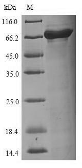 Recombinant Influenza A virus Nucleoprotein (NP)