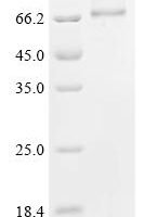 (Tris-Glycine gel) Discontinuous SDS-PAGE (reduced) with 5% enrichment gel and 15% separation gel.