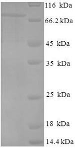 Recombinant Influenza A virus Nucleoprotein (NP)