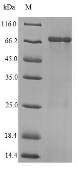 Recombinant Influenza A virus Nucleoprotein (NP)