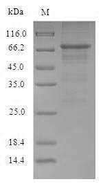 Recombinant Influenza A virus Nucleoprotein (NP), Influenza A virus (strain A/Puerto Rico/8/1934 H1N1), E.coli, N-terminal 6xHis-B2M-tagged, 70.2kDa, purity >90% as determined by SDS-PAGE.