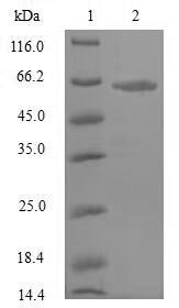 Recombinant Rat Atrial natriuretic peptide receptor 3 (Npr3), partial, Rattus norvegicus (Rat), E.coli, N-terminal 6xHis-SUMO-tagged, 64.9kDa, purity >90% as determined by SDS-PAGE.
