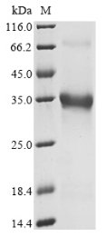 Recombinant Mouse Pro-neuropeptide Y (Npy), partial, Mus musculus (Mouse), Yeast, N-terminal hFc-tagged, 30.9kDa, purity >90% as determined by SDS-PAGE.