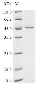 (Tris-Glycine gel) Discontinuous SDS-PAGE (reduced) with 5% enrichment gel and 15% separation gel.