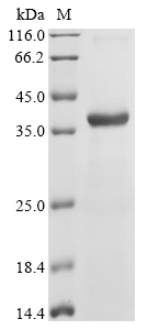 Recombinant Sandfly fever sicilian virus Non-structural protein NS-S (NSS)