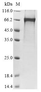 Recombinant Rat Netrin-1 (Ntn1) (X544S,X576S,X589S), Rattus norvegicus (Rat), E.coli, N-terminal 6xHis-tagged, 68.1kDa, purity >85% as determined by SDS-PAGE.