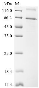 Recombinant Mouse Netrin-G1 (Ntng1), Mus musculus (Mouse), E.coli, N-terminal 10xHis-tagged and C-terminal Myc-tagged, 63.2kDa, purity >85% as determined by SDS-PAGE.