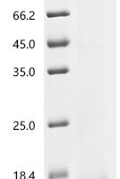 (Tris-Glycine gel) Discontinuous SDS-PAGE (reduced) with 5% enrichment gel and 15% separation gel.