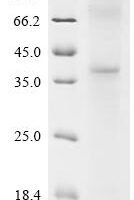 (Tris-Glycine gel) Discontinuous SDS-PAGE (reduced) with 5% enrichment gel and 15% separation gel.
