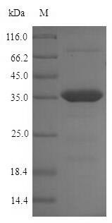 Recombinant Chlamydia trachomatis serovar D Large cysteine-rich periplasmic protein OmcB (omcB), partial