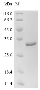 Recombinant Chlamydia pneumoniae Large cysteine-rich periplasmic protein OmcB (omcB), partial, Chlamydia pneumoniae (Chlamydophila pneumoniae), E.coli, C-terminal 6xHis-tagged, 24.2kDa, purity >95% as determined by SDS-PAGE.