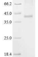 (Tris-Glycine gel) Discontinuous SDS-PAGE (reduced) with 5% enrichment gel and 15% separation gel.