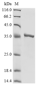 Recombinant Vaccinia virus DNA topoisomerase 1B (OPG111), Vaccinia virus (strain Copenhagen) (VACV), E.coli, N-terminal 6xHis-tagged, 40.7kDa, purity >90% as determined by SDS-PAGE.