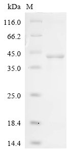 Recombinant Vaccinia virus Protein OPG190 (OPG190), partial