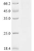 (Tris-Glycine gel) Discontinuous SDS-PAGE (reduced) with 5% enrichment gel and 15% separation gel.