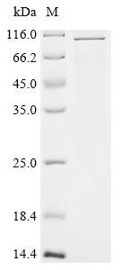 Recombinant Human Transient receptor potential cation channel subfamily V member 1 (TRPV1), partial Protein, Homo sapiens (Human), in vitro E.coli expression system, N-terminal 10xHis-tagged, 92.5kDa, purity >85% as determined by SDS-PAGE.