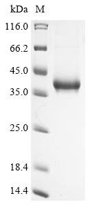 Recombinant Vaccinia virus Protein OPG190 (OPG190), partial