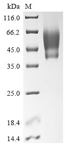 Recombinant Vaccinia virus Protein OPG190 (OPG190), partial