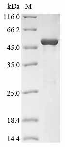Recombinant Varicella-zoster virus Tegument protein UL47 homolog (ORF11), partial, Varicella-zoster virus (strain Dumas) (HHV-3) (Human herpesvirus 3), E.coli, N-terminal 10xHis-tagged and C-terminal Myc-tagged, 58.3kDa, purity >85% as determined by SDS-PAGE.