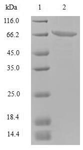 Recombinant Norovirus Capsid protein VP1 (ORF2)