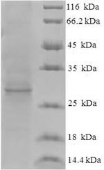 Recombinant Hepatitis E virus genotype 1 Protein ORF3 (ORF3), Hepatitis E virus genotype 1 (isolate Human/Pakistan/Sar-55) (HEV-1), E.coli, N-terminal 6xHis-SUMO-tagged, 27.8kDa, purity >90% as determined by SDS-PAGE.