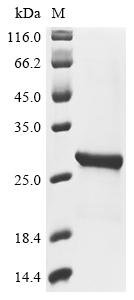Recombinant Carnation Italian ringspot virus RNA silencing suppressor p19 (ORF4), Carnation Italian ringspot virus (CIRV), E.coli, N-terminal 6xHis-tagged, 25.3kDa, purity >95% as determined by SDS-PAGE.