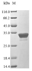 Recombinant Mycoplasma pneumoniae Adhesin P40/P90 (orf6), partial