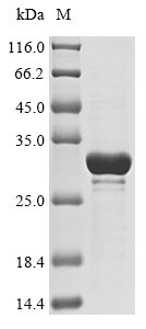 Recombinant Gorilla gorilla gorilla Orosomucoid 2 (ORM2)