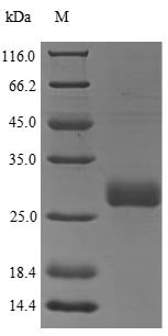 Recombinant Rat Oncostatin-M (Osm), Rattus norvegicus (Rat), Yeast, N-terminal 6xHis-tagged, 22.6kDa, purity >85% as determined by SDS-PAGE.