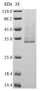 Recombinant Borrelia burgdorferi Outer surface protein A (ospA)