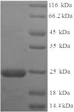 Recombinant Onchocerca volvulus OV-16 antigen (OV16)