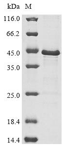 Recombinant Vesicular stomatitis Indiana virus Phosphoprotein (P), Vesicular stomatitis Indiana virus (strain Glasgow) (VSIV), E.coli, N-terminal 10xHis-tagged and C-terminal Myc-tagged, 34.9kDa, purity >85% as determined by SDS-PAGE.