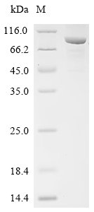 Recombinant Hepatitis B virus genotype D subtype ayw Protein P (P), partial, Biotinylated, Hepatitis B virus genotype D subtype ayw (isolate Italy/CI/1992) (HBV-D), E.coli, N-terminal MBP-tagged and C-terminal 6xHis-Avi-tagged, 87.2kDa, purity >85% as determined by SDS-PAGE.