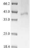 (Tris-Glycine gel) Discontinuous SDS-PAGE (reduced) with 5% enrichment gel and 15% separation gel.