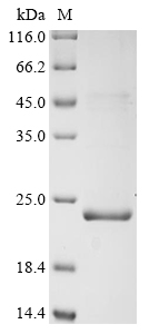 Recombinant Measles virus Phosphoprotein (P/V), partial, Measles virus (strain Edmonston) (MeV) (Subacute sclerose panencephalitis virus), E.coli, N-terminal 6xHis-KSI-tagged, 21.1kDa, purity >90% as determined by SDS-PAGE.