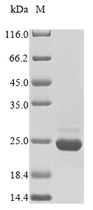 Recombinant Mycoplasma pneumoniae Protein P200 (p200), partial, Mycoplasma pneumoniae (strain ATCC 29342 / M129), E.coli, N-terminal 10xHis-tagged and C-terminal Myc-tagged, 23.2kDa, purity >85% as determined by SDS-PAGE.