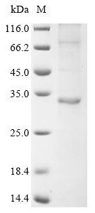 Recombinant Human papillomavirus type 16 Probable protein E5 (E5) Protein, Human papillomavirus type 16, in vitro E.coli expression system, N-terminal 10xHis-tagged and C-terminal GST-tagged, 36.4kDa, purity >85% as determined by SDS-PAGE.