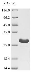 Recombinant African swine fever virus Inner membrane protein p54 (p54), partial, African swine fever virus (ASFV), E.coli, C-terminal 6xHis-tagged, 20.9kDa, purity >95% as determined by SDS-PAGE.