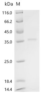 Recombinant Bovine Platelet-derived growth factor subunit B (PDGFB), partial, Bos taurus (Bovine), E.coli, N-terminal 10xHis-DsbA-tagged, 35.7kDa, purity >90% as determined by SDS-PAGE.