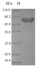 Recombinant Mouse Platelet-derived growth factor D (Pdgfd), Mus musculus (Mouse), E.coli, N-terminal 6xHis-SUMO-tagged, 56.2kDa, purity >90% as determined by SDS-PAGE.